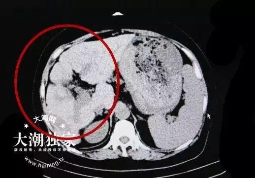 吃瓜CT,一场关于网络热点的深度探讨